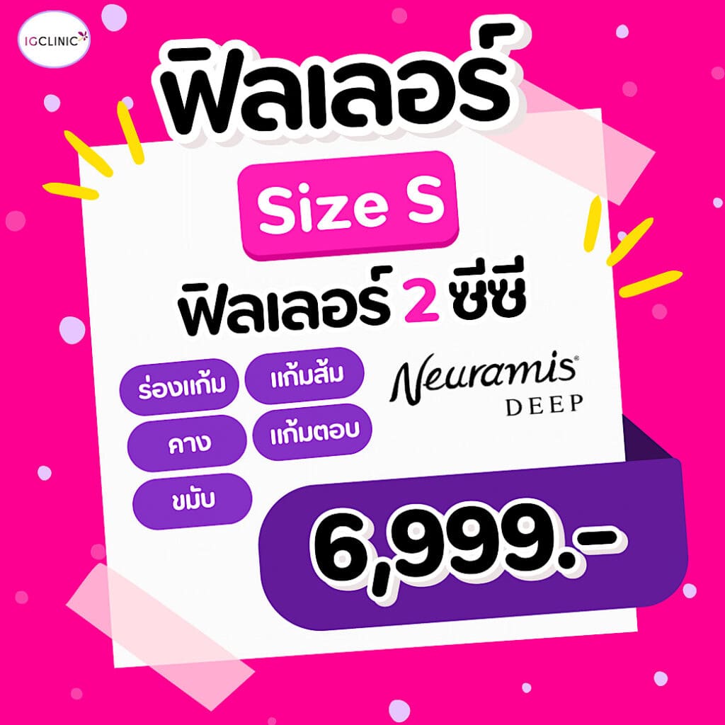 ฟิลเลอร์