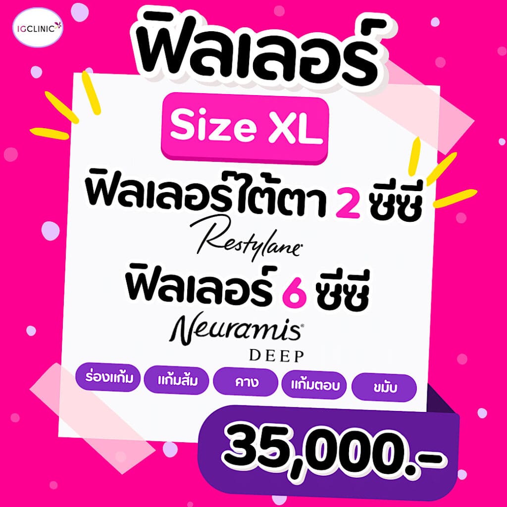 ฟิลเลอร์ - 4