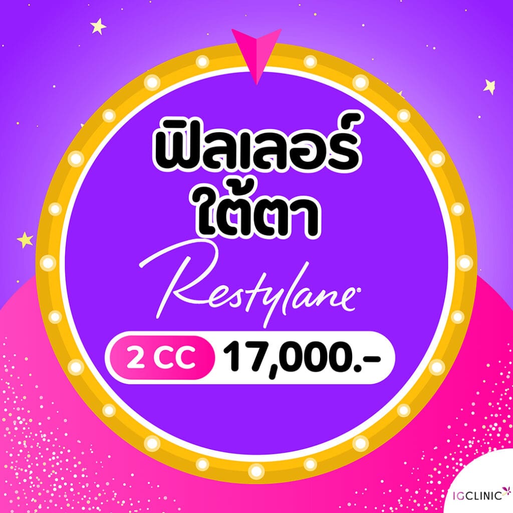 res17000